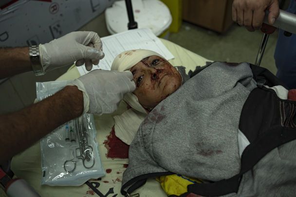 Guerra alle porte di Al-Shifa: perché Israele prende d'assalto il principale ospedale di Gaza (foto, video)