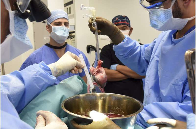 Il secondo uomo nella storia a ricevere un cuore di maiale trapiantato, morto 6 settimane dopo l'intervento chirurgico (foto)
