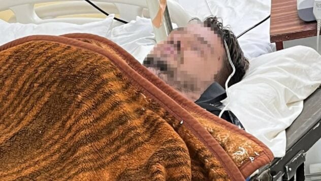 Cercato di attraversare il confine: 700 m prima della Romania, un uomo in ipotermia è stato trovato nel montagne